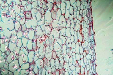 Nişasta tanecikli kereste. 100 kat fazla.