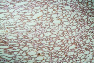 Alveollü sağlıklı akciğer dokusu 100 x