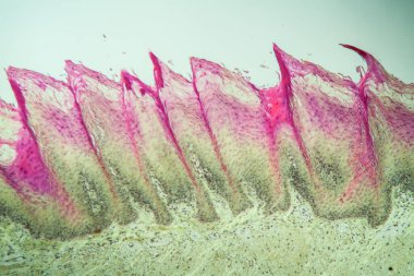 Tat alma tomurcukları olan dil dokusu 100 kat