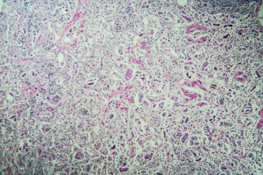 Mikroskop altında akciğer kurdu.