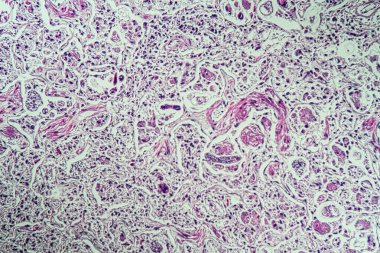 Mikroskop altında akciğer kurdu.