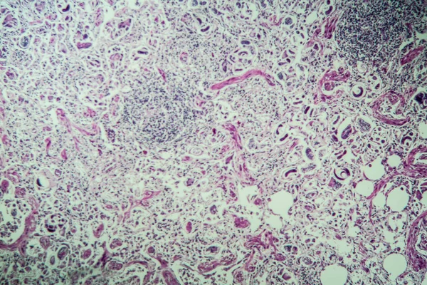 Lungworm Sob Microscópio 100X — Fotografia de Stock