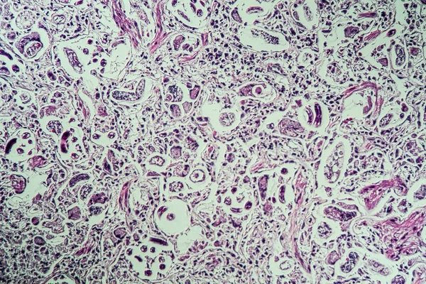 Lungworm Κάτω Από Μικροσκόπιο 100X — Φωτογραφία Αρχείου