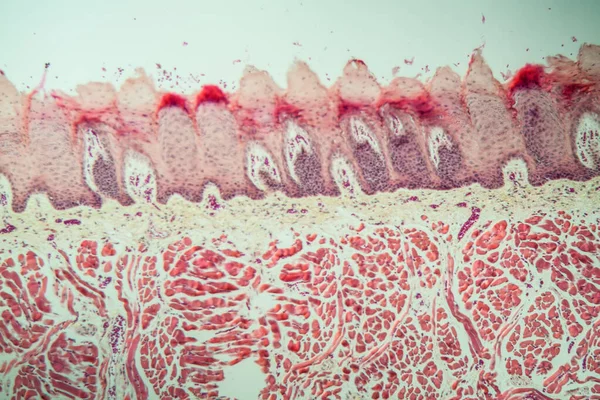 Zungengewebe Mit Geschmacksknospen Über 100X — Stockfoto