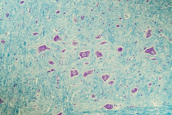 Células Nerviosas Bajo Microscopio 200X — Foto de Stock