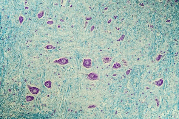 Komórki Nerwowe Pod Mikroskopem 200X — Zdjęcie stockowe