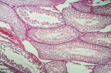 Kesişen bölümde sperm dokusu olan fare testisleri 100x