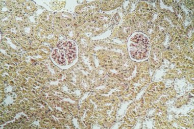 Mikroskop altında böbrek korteksi 100x