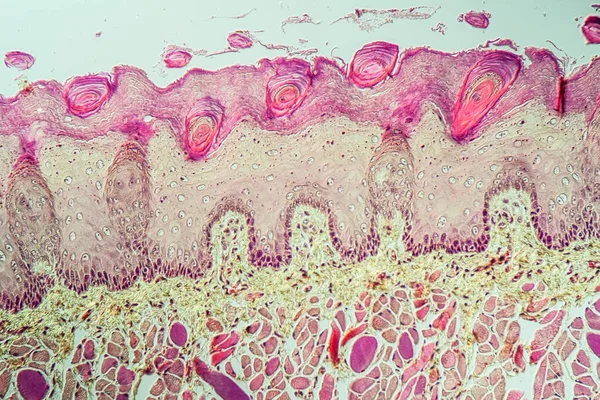 Tessuto Della Lingua Con Papille Gustative Attraverso 200X — Foto Stock