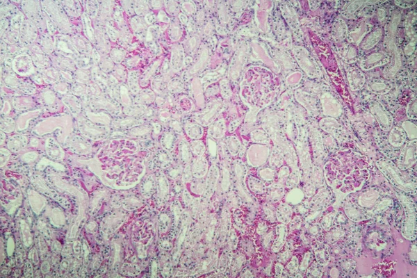 Korteks Kidney Bawah Mikroskop 100X — Stok Foto