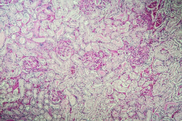 Korteks Kidney Bawah Mikroskop 100X — Stok Foto