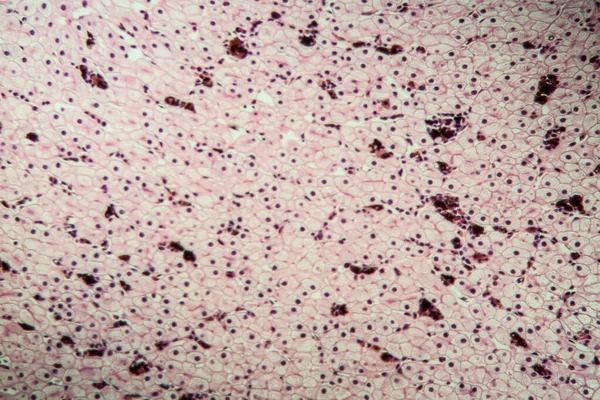 Аксолот Амфібії Печінковими Клітинами 100Х — стокове фото