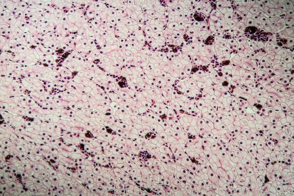 Axolot Amphibien Mit Leberzellen 100X — Stockfoto