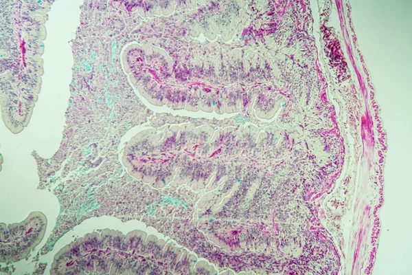 Pomalý Červ Histologie Střeva Příčný 100X — Stock fotografie