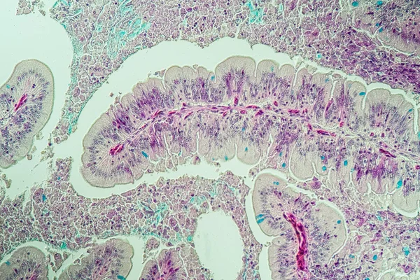 Lambat Cacing Histologi Usus Melintang 100X — Stok Foto