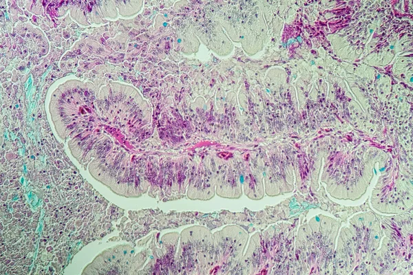 缓慢蠕虫组织学肠道横向100X — 图库照片