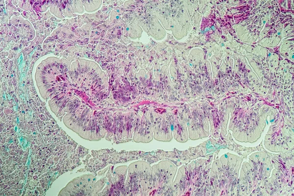 Lento Gusano Histología Intestinal Transversal 100X —  Fotos de Stock