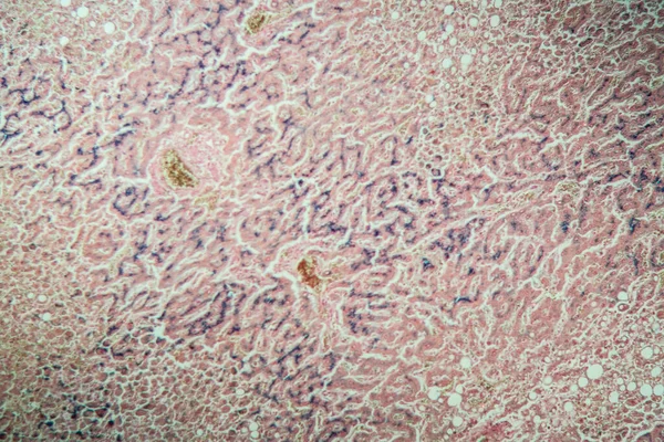 Hemozyderoza Wątroby 100X Pod Mikroskopem — Zdjęcie stockowe
