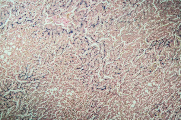 Hemosiderosis Hígado 100X Bajo Microscopio — Foto de Stock