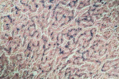 Hemosideroz karaciğer 200x mikroskop altında