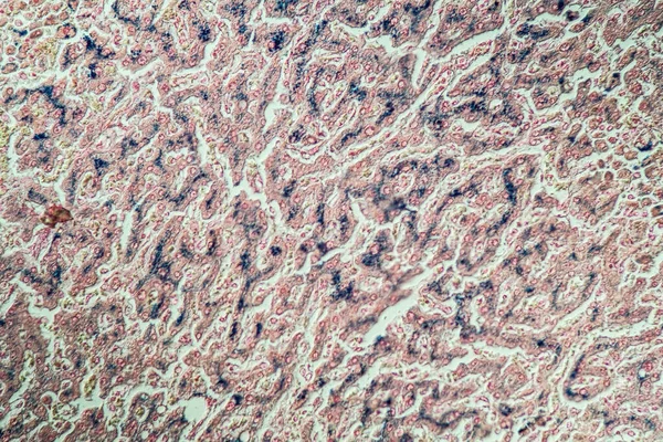 Hemosiderosis Hígado 200X Bajo Microscopio —  Fotos de Stock
