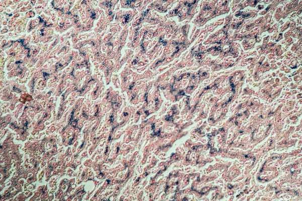 Hemosideroz karaciğer 200x mikroskop altında