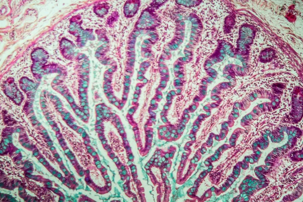 Intestin Grêle Avec Villosités Microscope 100X — Photo