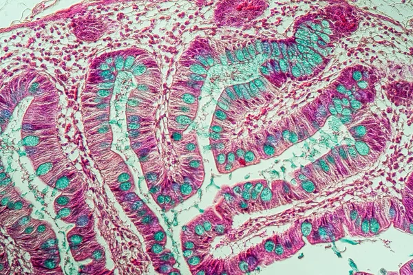 Intestin Grêle Avec Villosités Microscope 200X — Photo