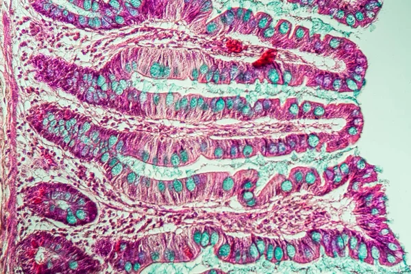 Intestin Grêle Avec Villosités Microscope 200X — Photo