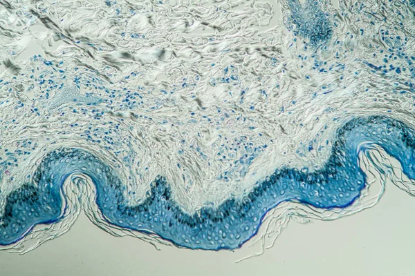 Skóra Trądu Pod Mikroskopem 200X — Zdjęcie stockowe