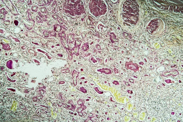 Зменшена Тканина Нирки Під Мікроскопом 100X — стокове фото
