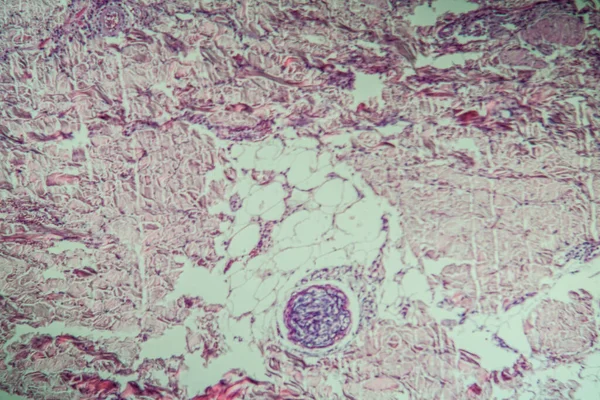 Tessuto Infezione Varicella Microscopio 100X — Foto Stock