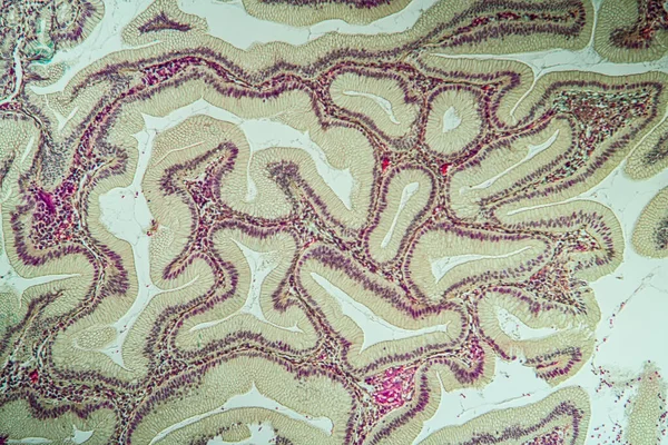 Jelito Grube Tkanką Uchyłkową Pod Mikroskopem 100X — Zdjęcie stockowe