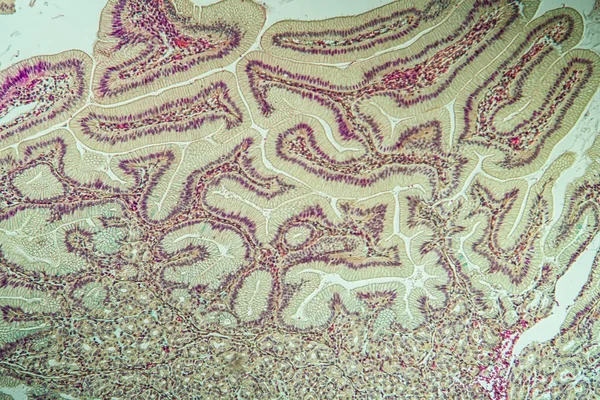 Intestino Crasso Con Tessuto Diverticolare Microscopio 100X — Foto Stock