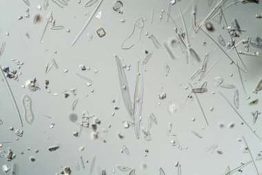 Tuna Kanalı 'ndan farklı türde Kiersel yosunları, 200x