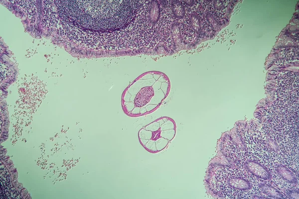 Ossiuride Tenia Nell Intestino Microscopia 100X — Foto Stock