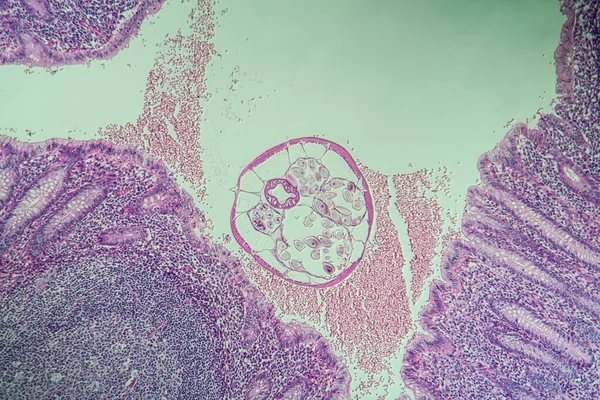 Oxiuris 腸内のピンワーム 顕微鏡像100倍 — ストック写真