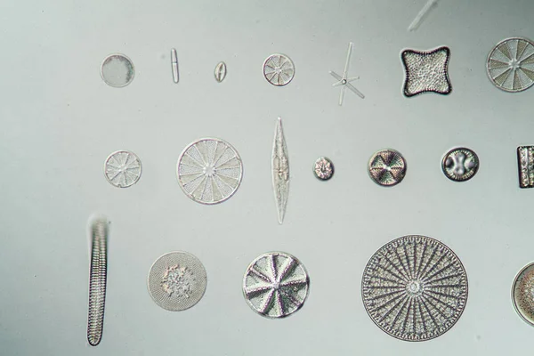 Diferentes Tipos Diatomáceas 100X — Fotografia de Stock