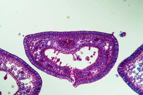 Sección Transversal Hoja Brezo Bajo Microscopio 200X — Foto de Stock