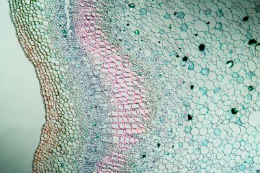 Kökeni 100x kesitinde olan Willonerb