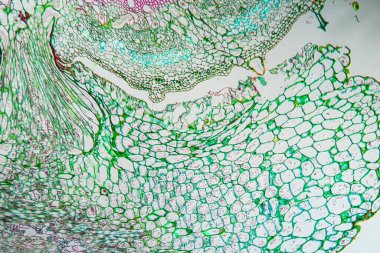 Isırgan otunun üzerindeki cadı ipliği Parazit bitkisinin 100 katı