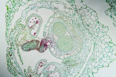 Isırgan otunun üzerindeki cadı ipliği Parazit bitkisinin 100 katı