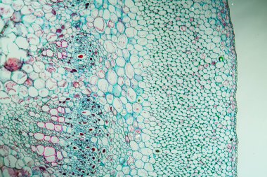 Çapraz bölüm 100x dallı asma.