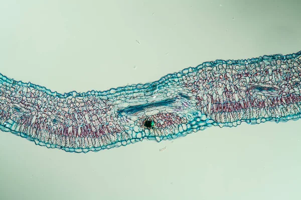 Willowherb with leaf in cross section 100x