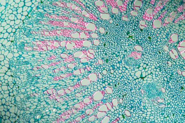 Böbrek fasülyesi etüdü kesiti 100x