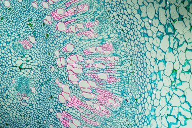 Böbrek fasülyesi etüdü kesiti 100x