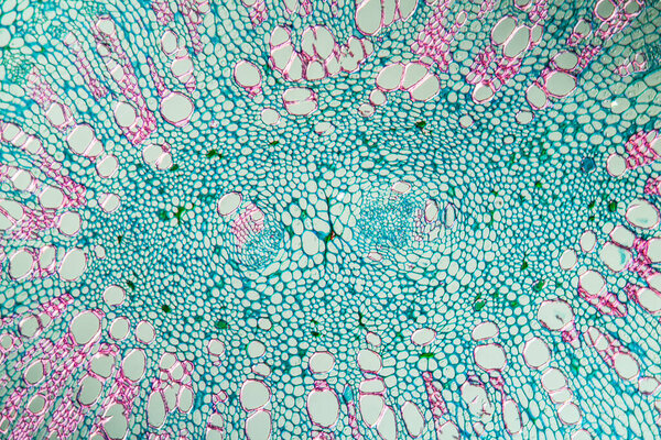 Kidney bean petiole cross section 100x
