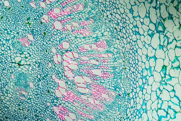 Vesebab Petiole Keresztmetszete 100X — Stock Fotó