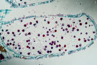 Çapraz bölümde at kuyruğu filizi. 100x