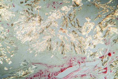 Hücrelerin doku bölümünde artrit gut kristalleri 100x